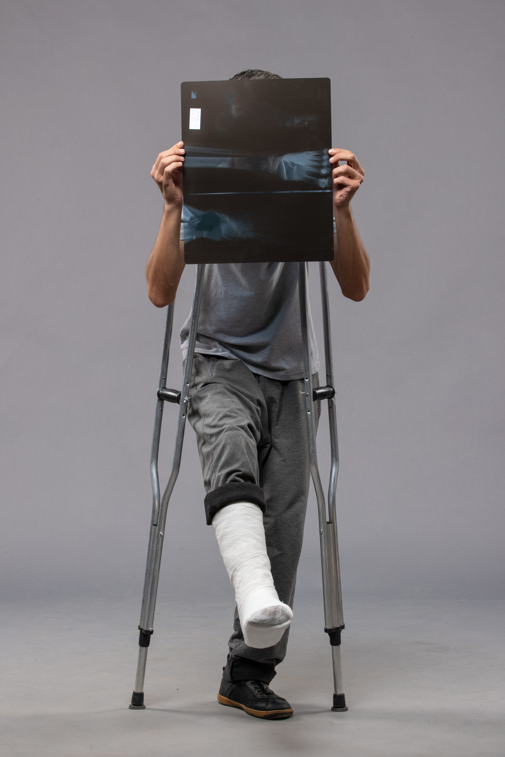 front view young male with broken foot using crutches holding his x ray grey wall disable twist broken accident pain foot